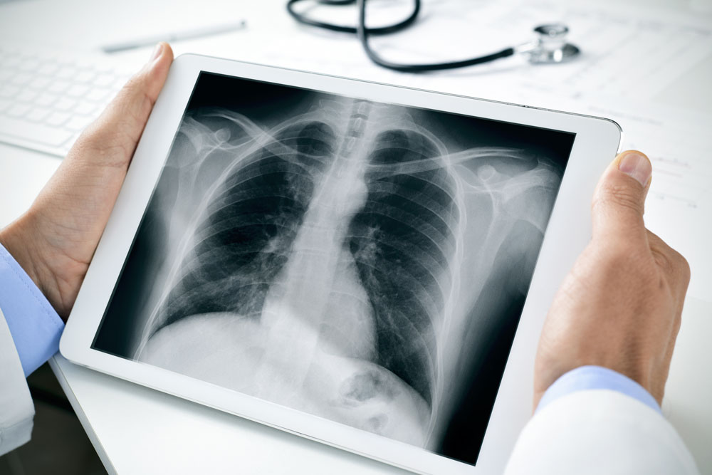 Digital Radiography | Mid Rogue Imaging Center