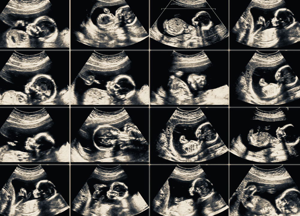 ultrasound_121140277-1000
