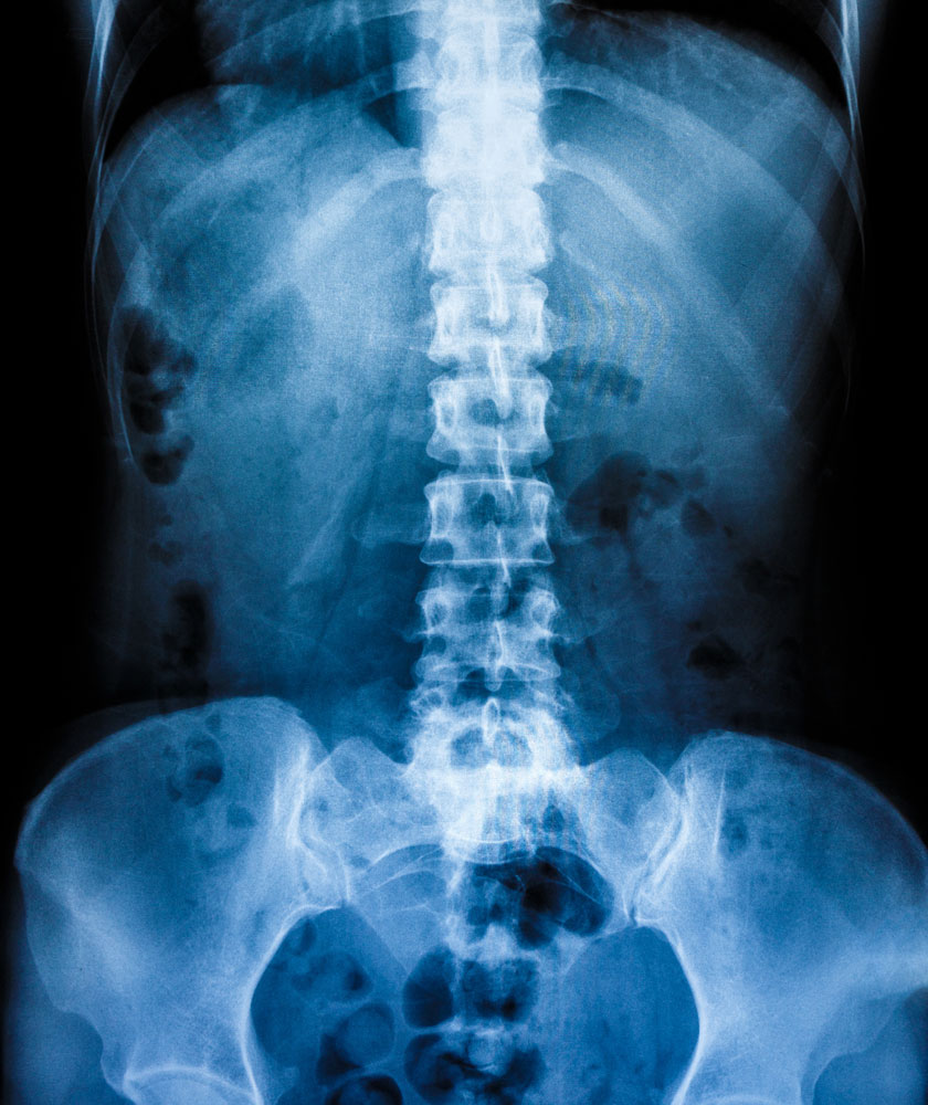 bone-densitometry-dxa-mid-rogue-imaging-center