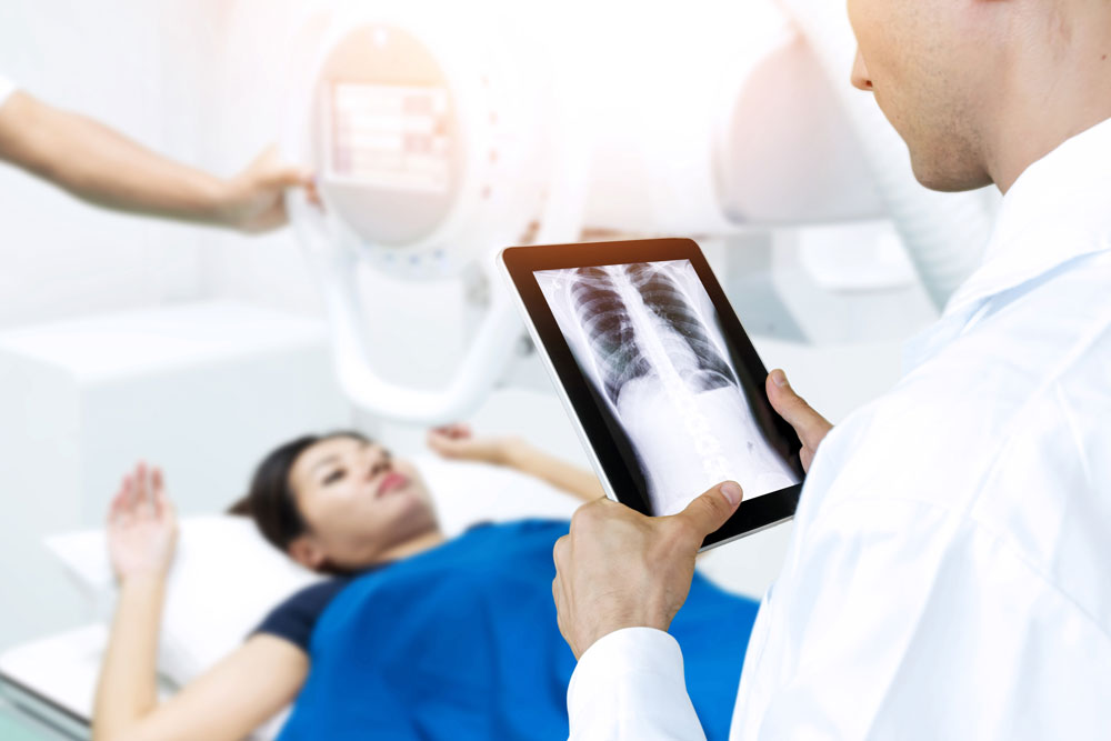 xray_170562933-1000